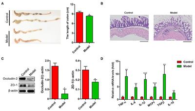 Schistosoma japonicum Infection Leads to the Reprogramming of Glucose and Lipid Metabolism in the Colon of Mice